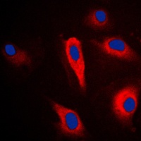 KRT16 antibody