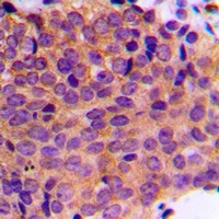 Anti-Cytokeratin 19 Antibody