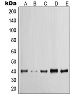Cytokeratin 19 Rabbit Polyclonal Antibody