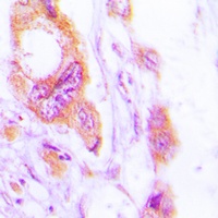 Cytokeratin 19 Rabbit Polyclonal Antibody