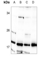STMN1 Rabbit Polyclonal Antibody