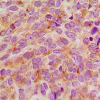 STMN1 Rabbit Polyclonal Antibody