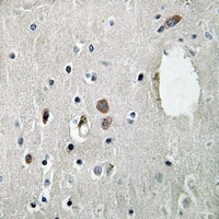 Anti-SLP76 (Phospho-Y128) Antibody