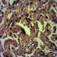 Anti-SLP76 Antibody