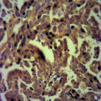 LCP2 antibody