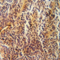 LGALS1 antibody