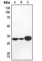 Galectin 3 Antibody [KO/KD Validated]