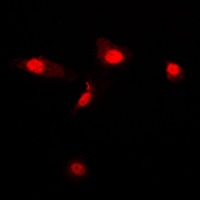 Galectin 3 antibody