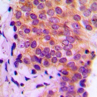 Anti-Galectin 9 Antibody