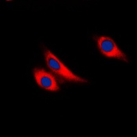 Anti-Galectin 9 Antibody