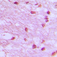 Anti-DNA Ligase 4 Antibody