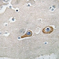 Anti-LIMK1 Antibody