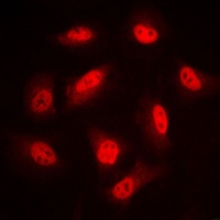 Anti-LIMK1/2 (Phospho-T508/505) Antibody