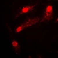 LIMK2 Antibody