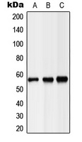 Hepatic Lipase Rabbit Polyclonal Antibody
