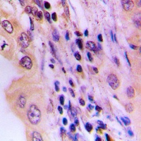 Anti-Hepatic Lipase Antibody