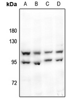 HSL Rabbit Polyclonal Antibody
