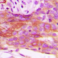 HSL Rabbit Polyclonal Antibody