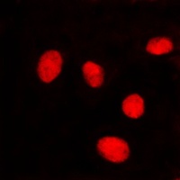 Anti-Lamin A/C Antibody