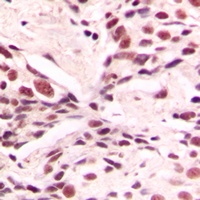 LMX1B antibody