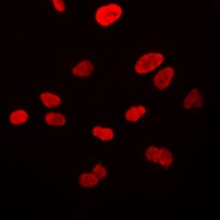 Anti-VWA5A Antibody