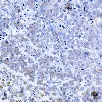 Anti-TNF beta Antibody
