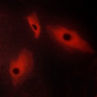 Anti-LTBR Antibody