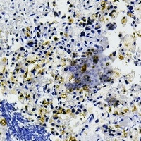 LY75 antibody