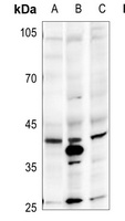 CD326 Rabbit Polyclonal Antibody