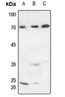 MARCKS (Phospho-S163) Antibody