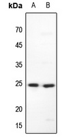 MAD2 Rabbit Polyclonal Antibody