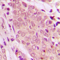SMAD2/3 Rabbit Polyclonal Antibody