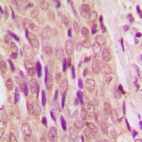 Anti-SMAD4 Antibody