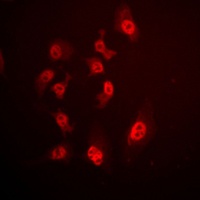 Anti-SMAD4 Antibody