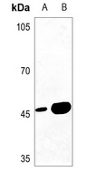 MAGEA1 Antibody