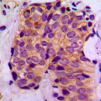 Anti-MAGEA1 Antibody