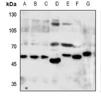 Monoamine Oxidase A Rabbit Polyclonal Antibody