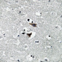 Monoamine Oxidase A Rabbit Polyclonal Antibody