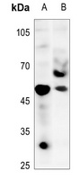 TAU (Phospho-T548) Antibody