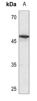 TAU Rabbit Polyclonal Antibody