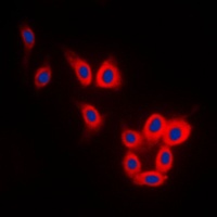 TAU Rabbit Polyclonal Antibody