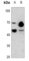 TAU Rabbit Polyclonal Antibody