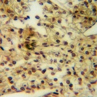 TAU Rabbit Polyclonal Antibody
