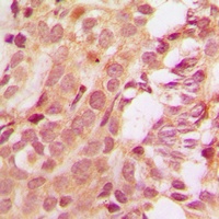 Anti-MCL1 Antibody