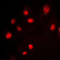 Anti-MCM2 Antibody