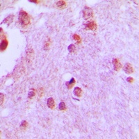 CDC46 Antibody