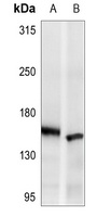 ASK1 Antibody