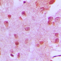 Anti-Menin Antibody