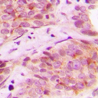 Anti-Mammaglobin B Antibody