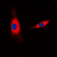 Anti-Mammaglobin B Antibody